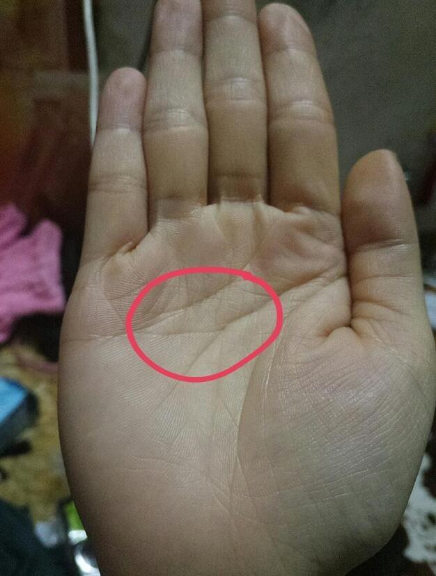 右手类断掌(不够标准的断掌),左手天地纹格局不够开,断掌之人初期波折