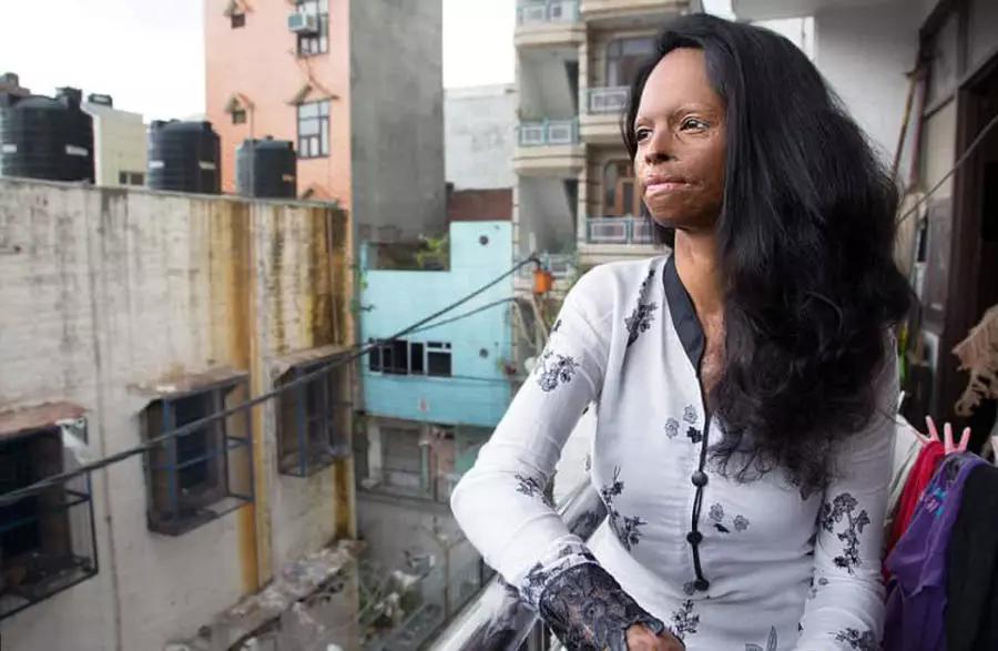 印度女性常被硫酸毁容,有的因为拒绝求爱,有的因为生不出儿子