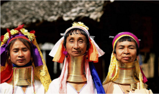 这里女性以脖子长为美最长达到60厘米,脖子上戴着20斤重圈圈