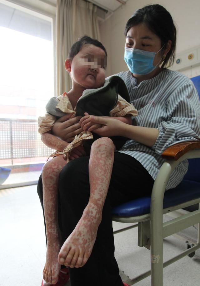 孩子高烧不退黄女士被医生告之病因后内心几乎奔溃