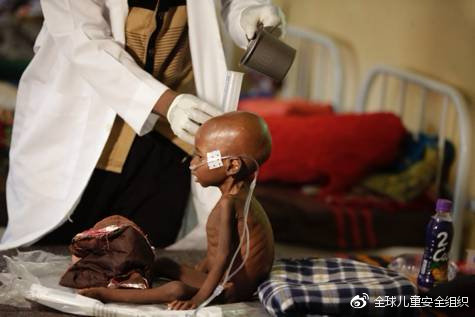 多名5岁以下儿童离开这个世界|儿童|死亡率|世界卫生组织_新浪新闻