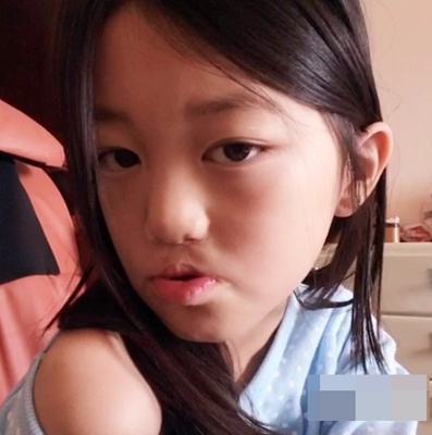 王菲女儿李嫣经3次整容治疗,如今容貌大变样,颜值不输天后