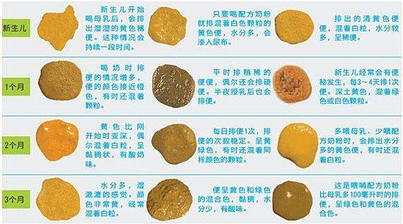 宝宝正常的便便到底应该长啥样?
