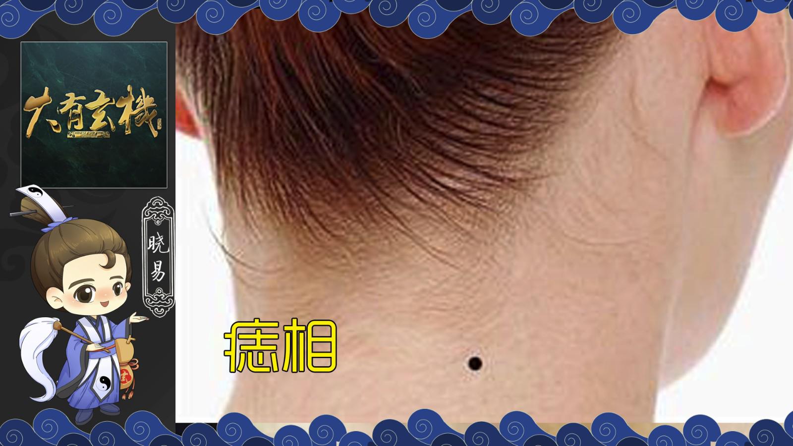 身上这几个地方长痣是大凶之相 如何化解 否则霉运连连 大有玄机