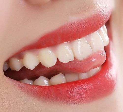 抽烟喝酒牙齿发黄洗牙也没用? 刷牙时用点粉末, 黄牙很快就变白牙