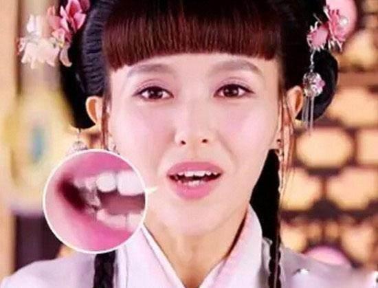 有种遗憾叫做唐嫣的牙齿,baby的下巴,而她的遗憾却人人都想要!