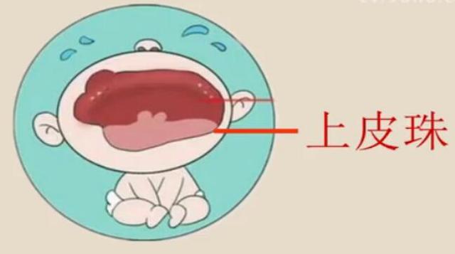 宝宝口腔里的小白点是什么?