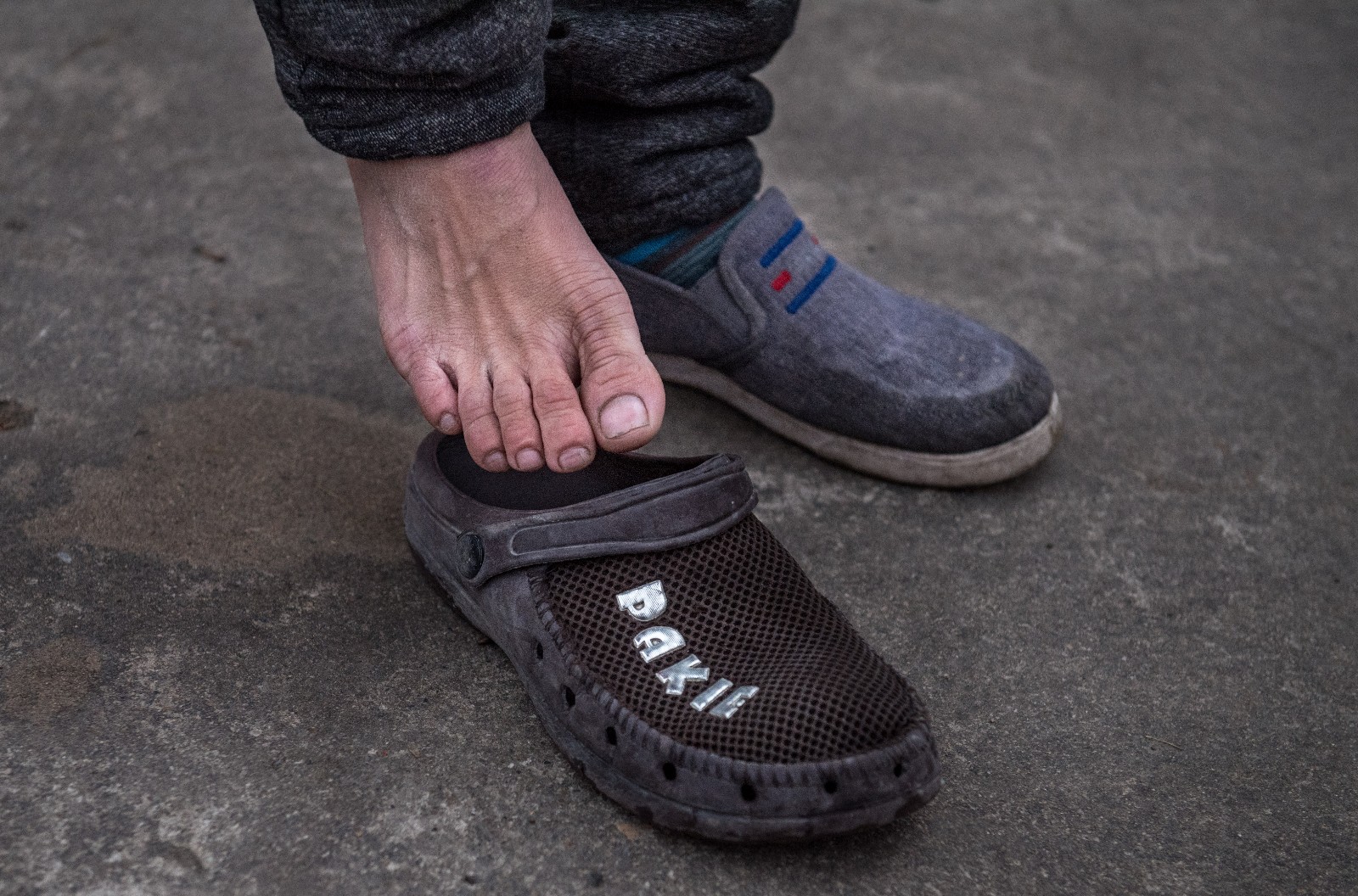 湖北23岁无臂男孩以脚当手读小学六年级