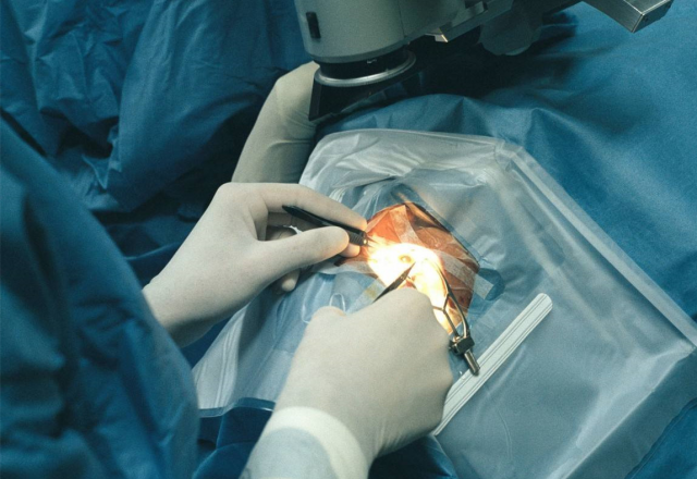 刘武教授介绍:"如果是早期的黄斑小裂孔,手术能取得非常好的效果,黄斑