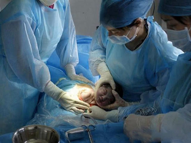 婆婆天天逼儿媳吃这"转胎药"