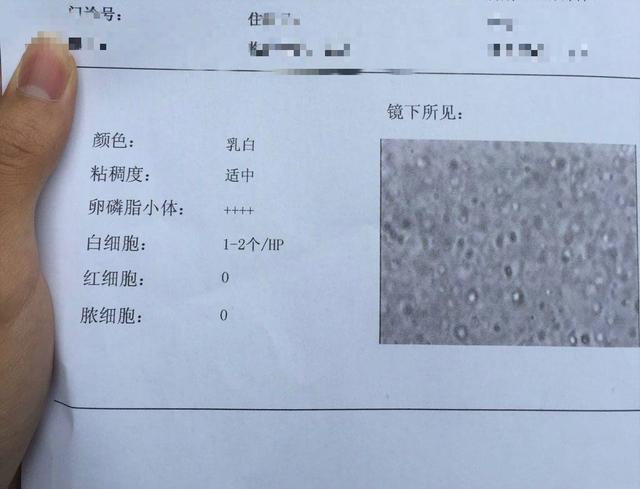 前列腺炎男性提高卵磷脂小体就这一招