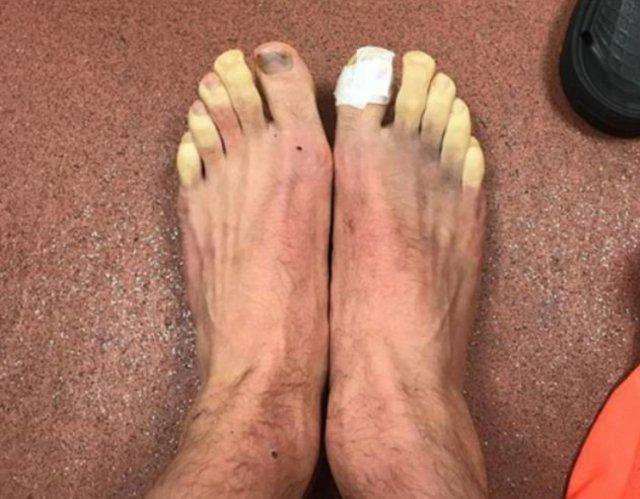 国足为什么不行,看看大罗的脚趾,再看看他们的脚,就知道差在哪