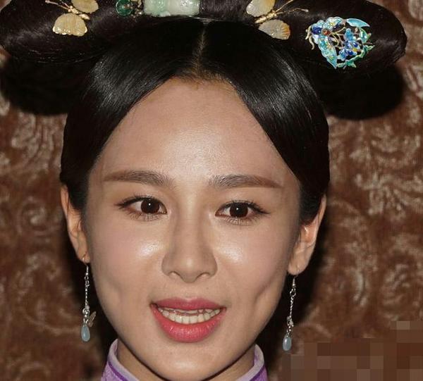 杨紫瘦了18斤之后脸更僵了,居然还撞脸林心如?