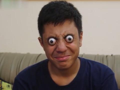 惊奇!现实版"瞠目结舌",巴基斯坦少年可将半个眼球瞪出眼眶