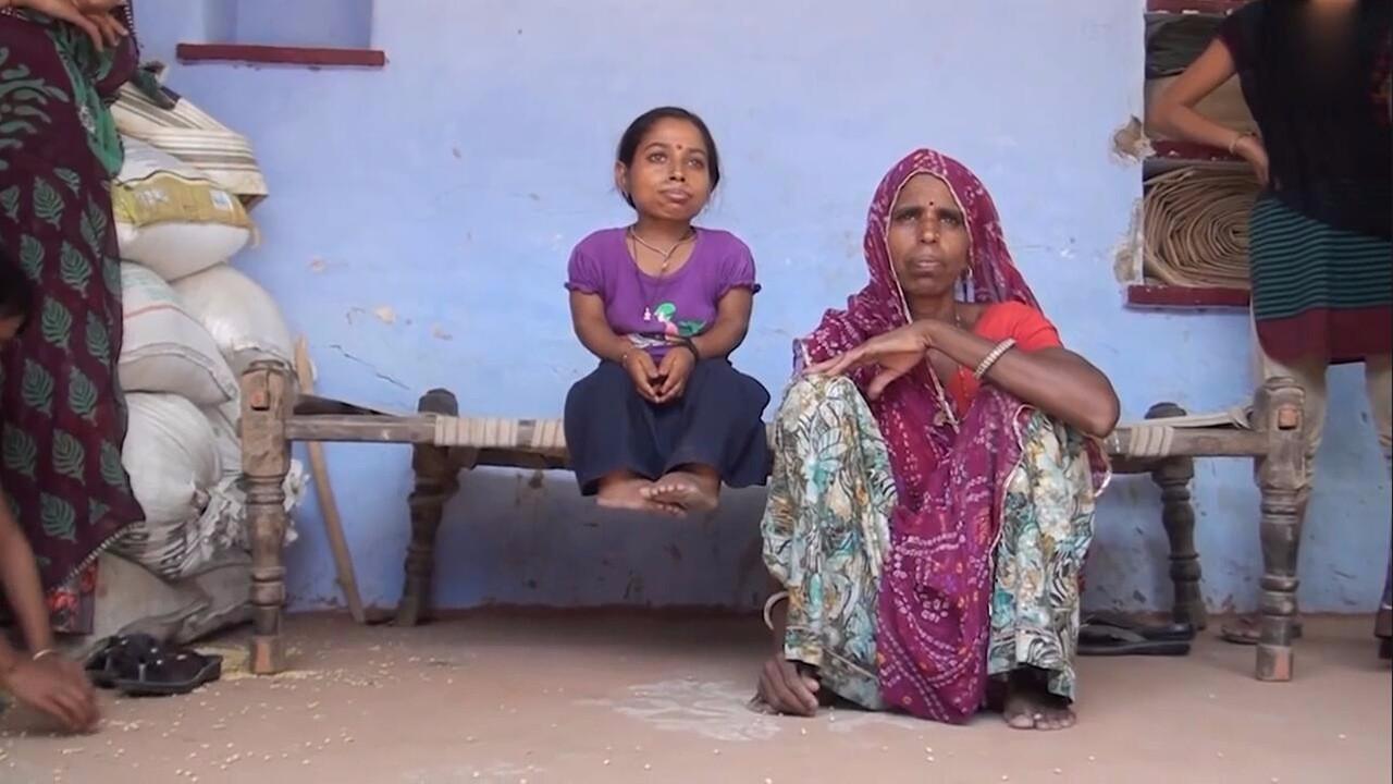 印女子患罕见侏儒症高0.8米 做好终身不嫁准备