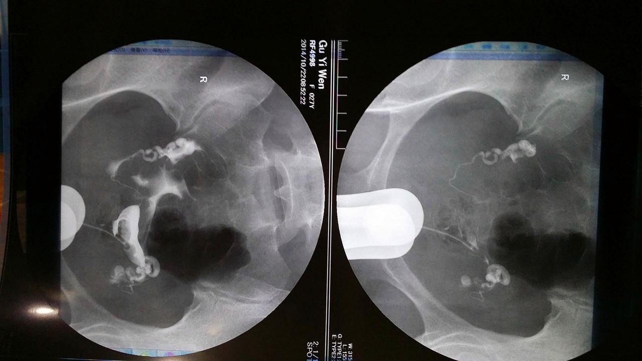 产检次数越多对胎儿越好很多准妈妈都错了