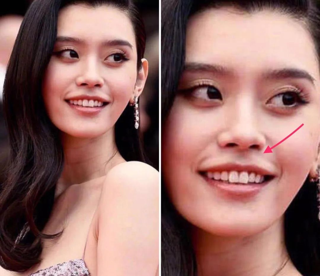 恰巧的是,奚梦瑶嘴唇上方,也有一条横穿人中的纹路,非常显眼.