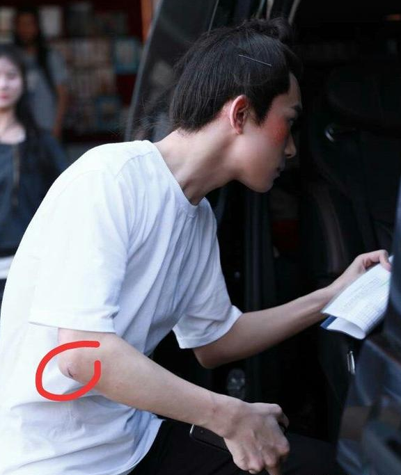 易烊千玺拍打戏被粉丝调侃,看到千玺的胳膊粉丝开始心疼了