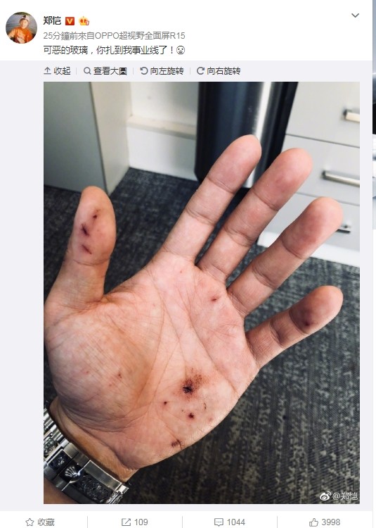 《跑男》郑恺受伤! 网惊「割痕部位」:严重了
