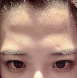 额头是否塌陷,代表哪种运势呢?