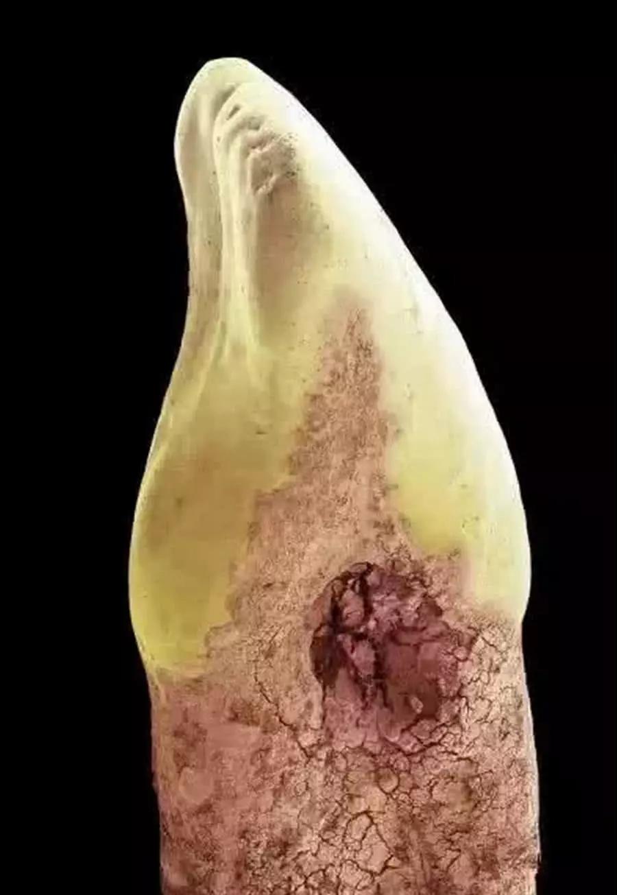 皮肤放大1000倍,皮肤放大1000倍图片 人体器官放大1000倍后是啥样指甲变黄土保证你会重新认识自己
