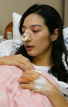 李敏英嫁入豪门结婚13天被丈夫砍断手指,怀孕被家暴流产