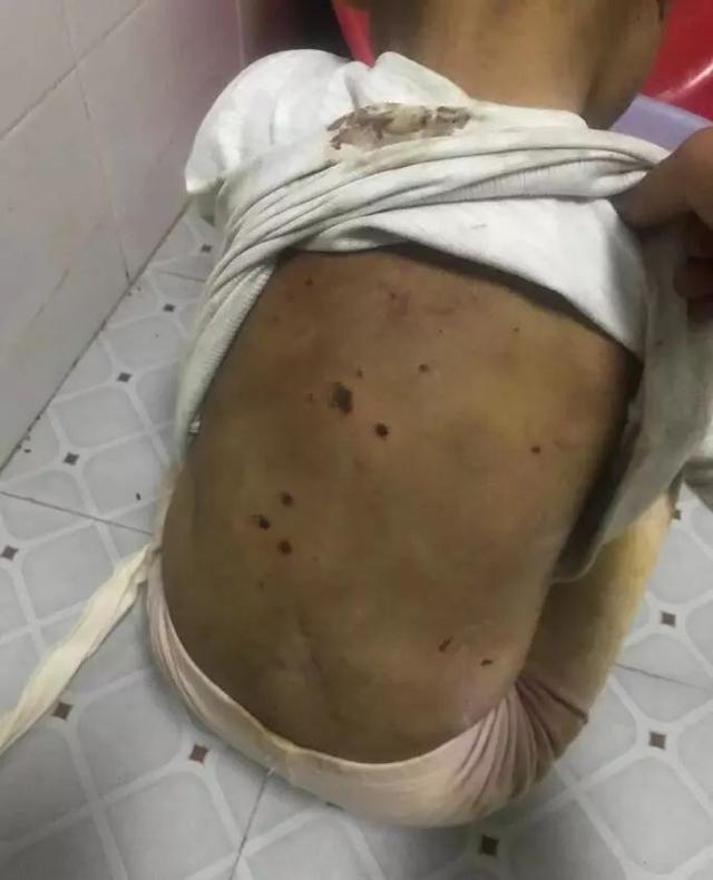 据该网友描述:"这是清镇云岭小区一个虐童事件.