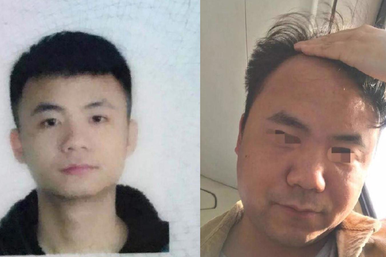 熬夜四年前后对比照堪比毁容,究竟有多少人在拿生命来作践自己?|熬夜|毁容|生物钟|究竟|生命_新浪新闻