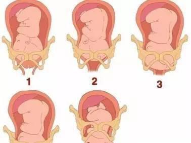 生娃时宫开十指时你一定要这样做否则一辈子遗憾