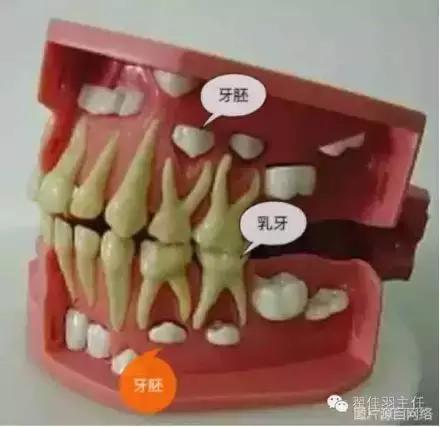 从这张"3岁宝宝乳牙模型"的图片中可以看出,恒牙是"潜伏"在乳牙下面