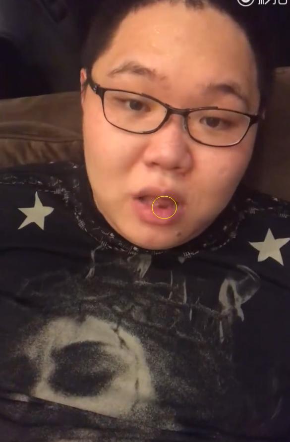 pdd续约成功,疑似现在成都忙于"整容"!骚猪戒烟,要结婚了?