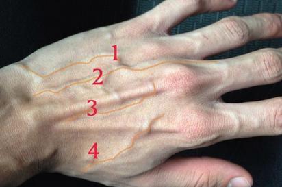 为什么有人手背上的青筋很粗很明显?别乱猜,这次告诉你真正答案