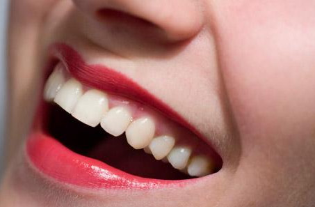 舌侧矫正后牙齿护理要注意些什么呢?