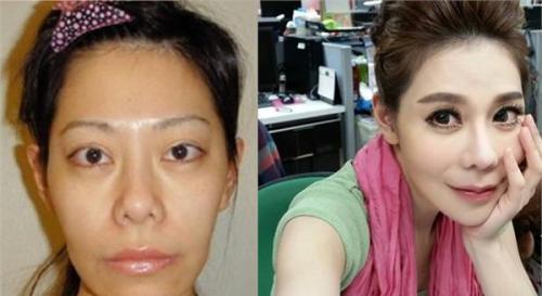 女子22年整容60次,虽漂亮得像个洋娃娃,但后遗症让她苦不堪言