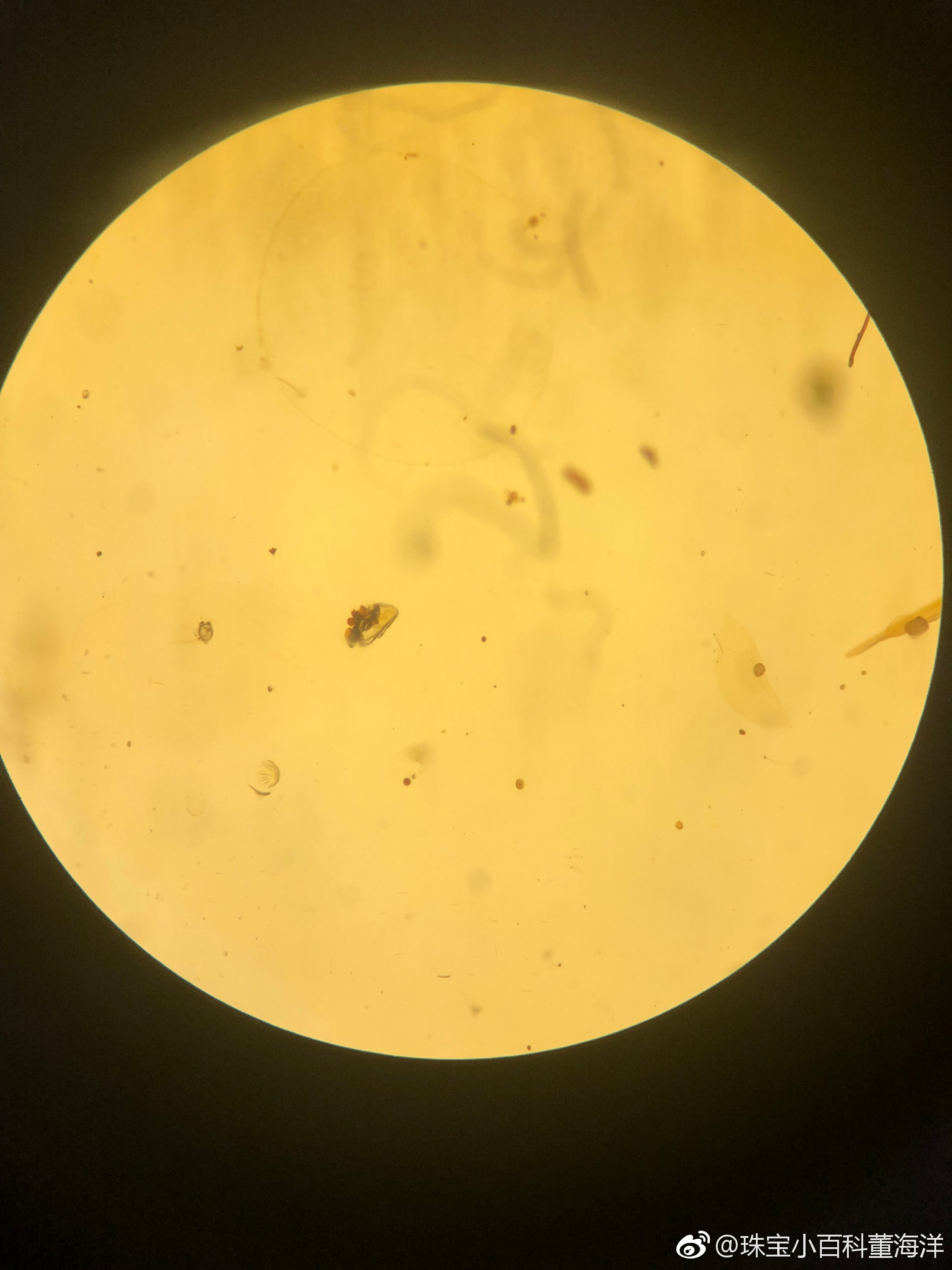 虫珀里的微观世界这只奇蝽被封存的姿态也太优美了这是在跳舞么