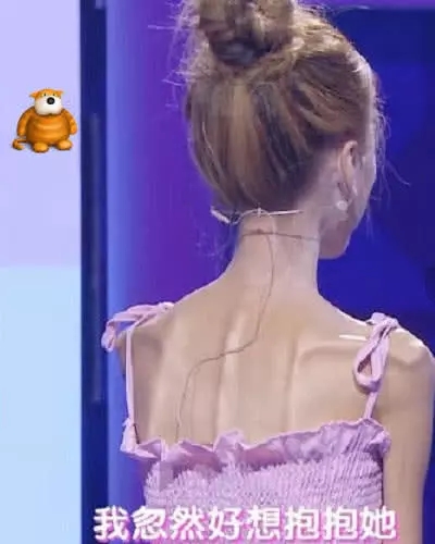 骷髅妹为爱暴瘦70斤见了她背部之后网友直言吓人