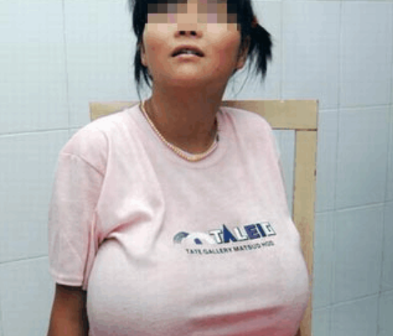 13岁女孩胸部大的异常受尽同学嘲笑手术过后让她重获新生