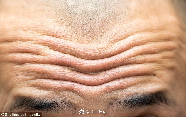 最新研究表明抬头纹越深越容易患上心血管疾病