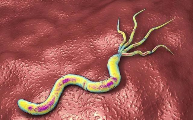 可能感染了幽门螺旋杆菌,别傻傻还不知道|杆菌|幽门|细菌_新浪新闻