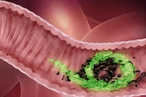 体内毒素一旦过多, 身体就会出现这些表现, 你可别错过了!