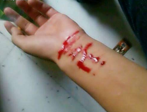 女孩为试探男友还爱不爱自己,"割腕自残"发朋友圈惊动警方!