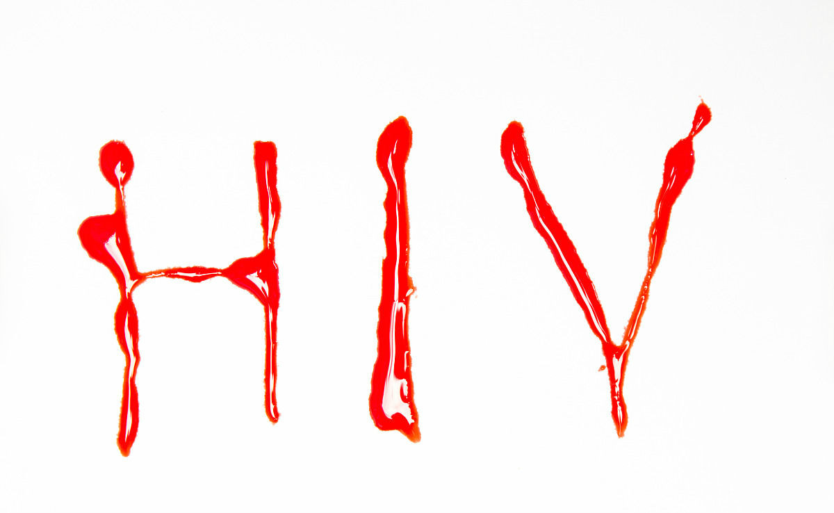 艾滋病的三个信号一定要小心,医生说这三类人一定要检查hiv!