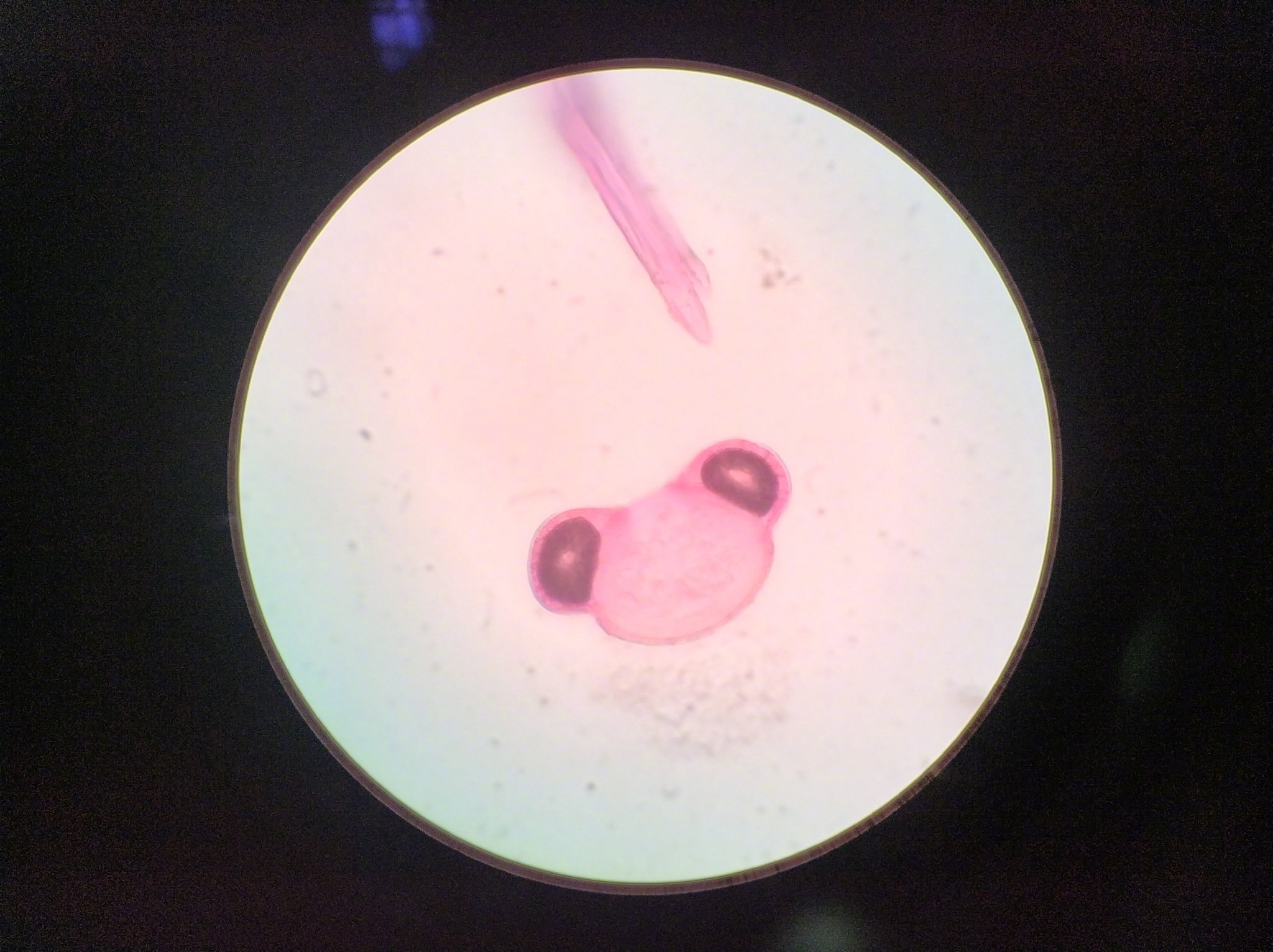 致敏度高,这放大 40倍镜和100倍镜光学显微镜下的松树花粉图您见过吗?