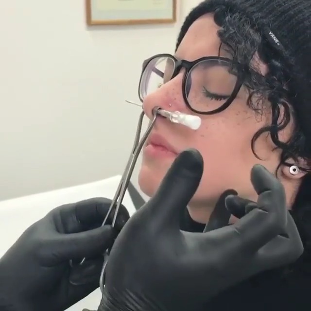 打鼻环.每次看见一堆环的脸,就觉得好疼