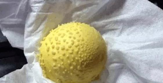 滚鸡蛋祛湿是不是真的啊 给你最权威的回答