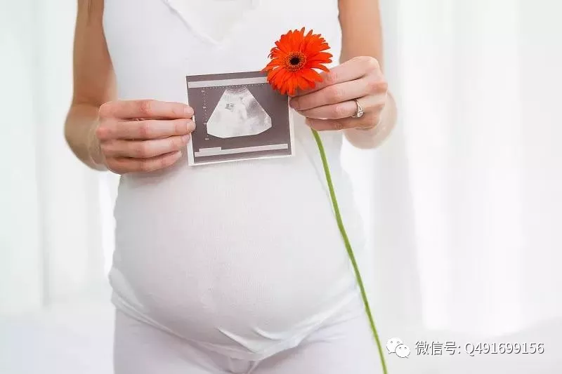 做四维彩超前,这7件事孕妈要提前准备好|四维|胎儿|孕妈_新浪新闻