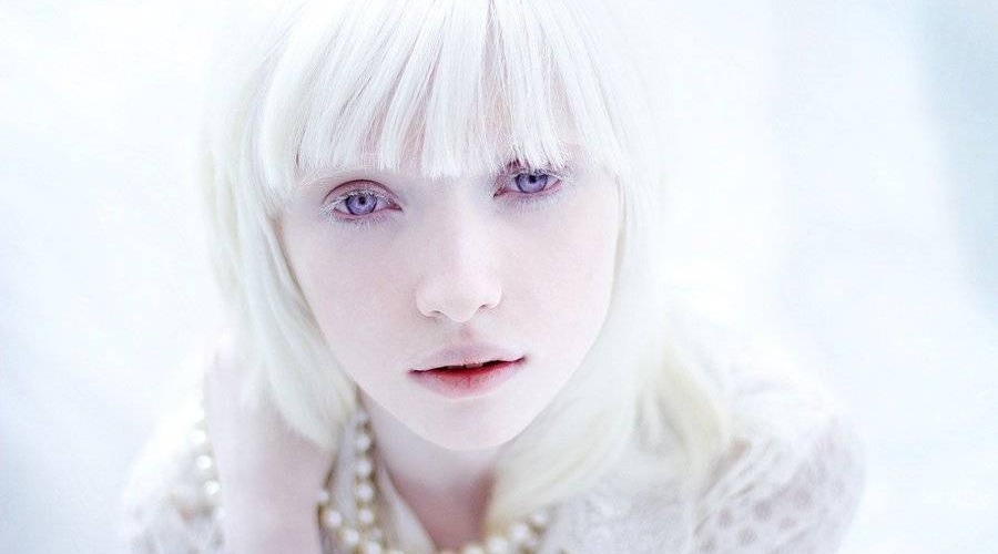 乌克兰"白雪公主",天生白化病,雪白皮肤紫色瞳孔如同天使