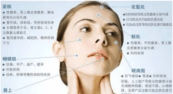 从脸上看妇科病, 别说还真准