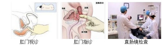 直肠指检对肛门疾病的诊断有何重要意义