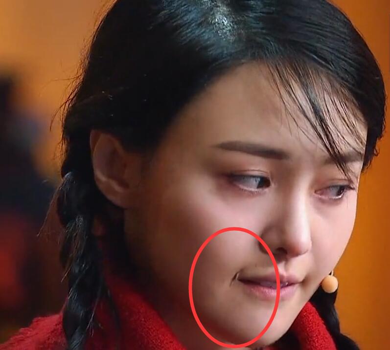 郑爽嘴角的伤疤,连化妆师都无能为力,网友:可惜了这张脸